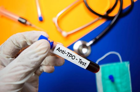 انجام آزمایش Anti TPO برای چه کسانی ضرورت دارد؟ انجام آزمایش Anti TPO برای چه کسانی ضرورت دارد؟